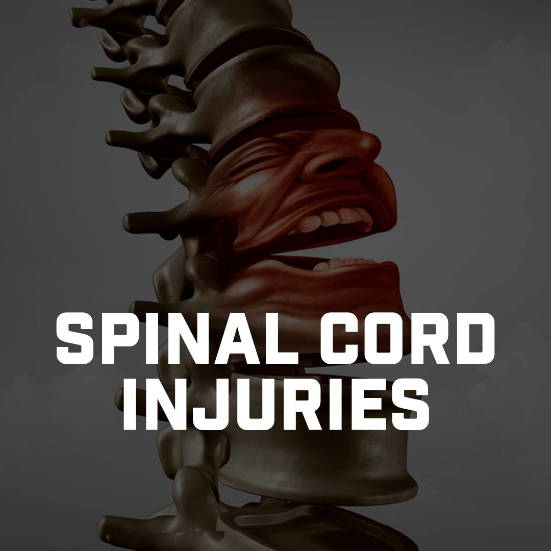 Spinal Cord Injuries – University Of Vermont Health Network Critical ...